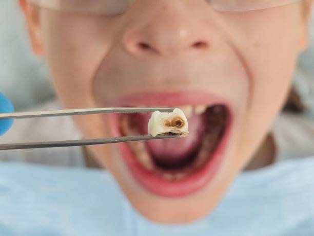 Best Broken Tooth Emergency  in Mercedes, TX