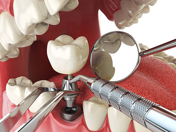 Best Emergency Tooth Extraction  in Mercedes, TX